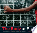 The body at risk : photography of disorder, illness, and healing /