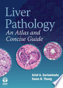 Liver pathology : an atlas and concise guide /