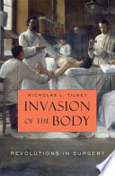 Invasion of the body : revolutions in surgery / Nicholas L. Tilney.