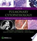 Atlas of pulmonary cytopathology : with histopathologic correlations /